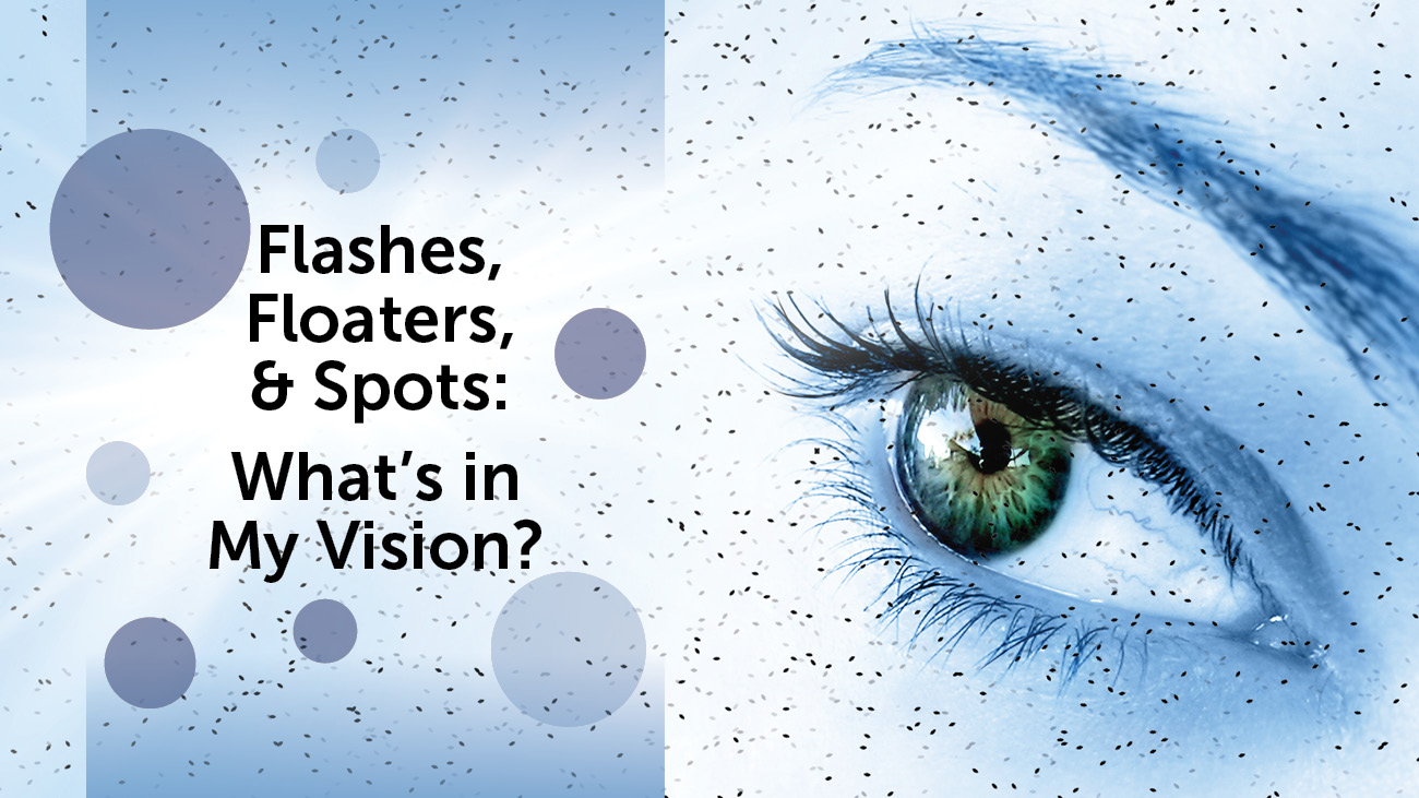 Do you see spots in your vision? What is normal and what is not?